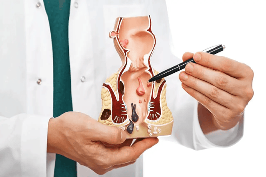 Beyond Temporary Relief: Managing Piles, Fissures, and Fistula with the Pysam Kit